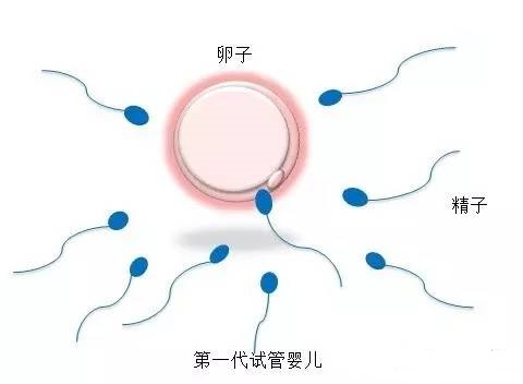 妇科微创